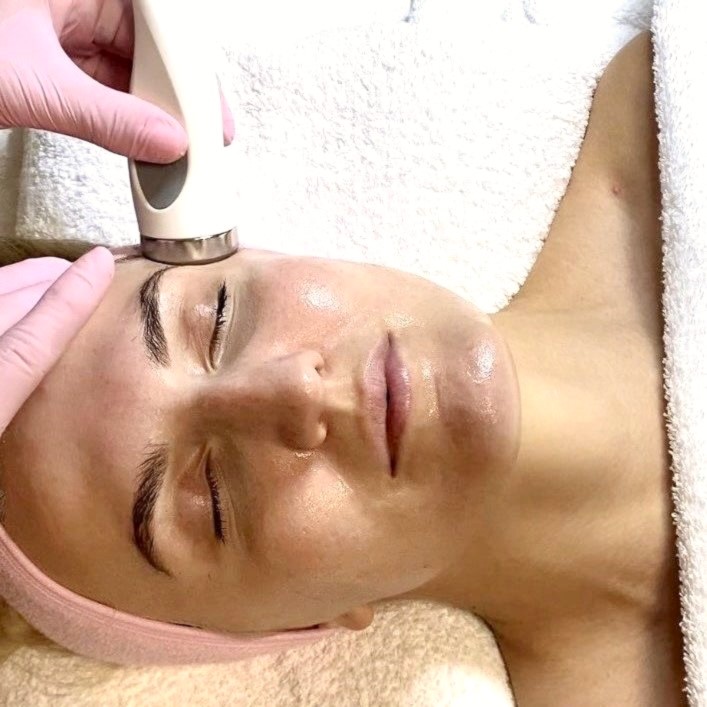 Timantti + sonoforeesi  kasvohoito Helsinki, Marijellassa.