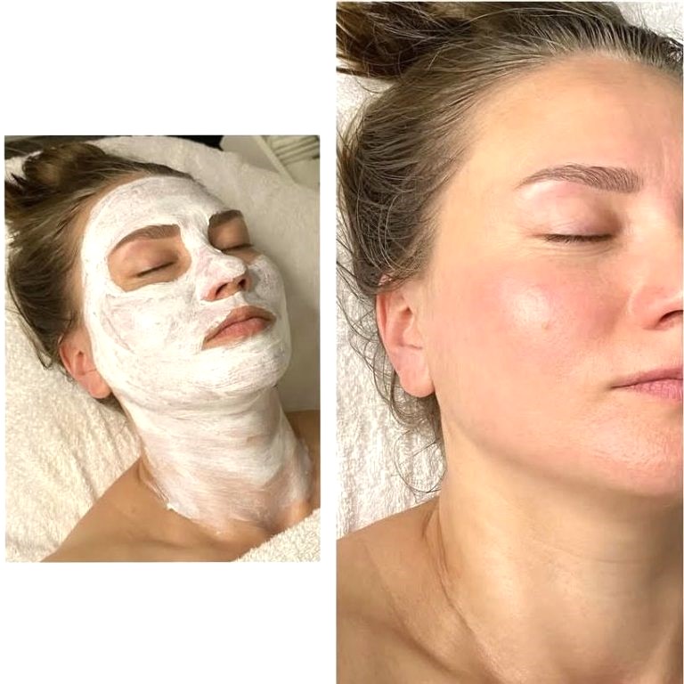 Kasvohoto Helsinki Marijellassa, Etu-Töölö