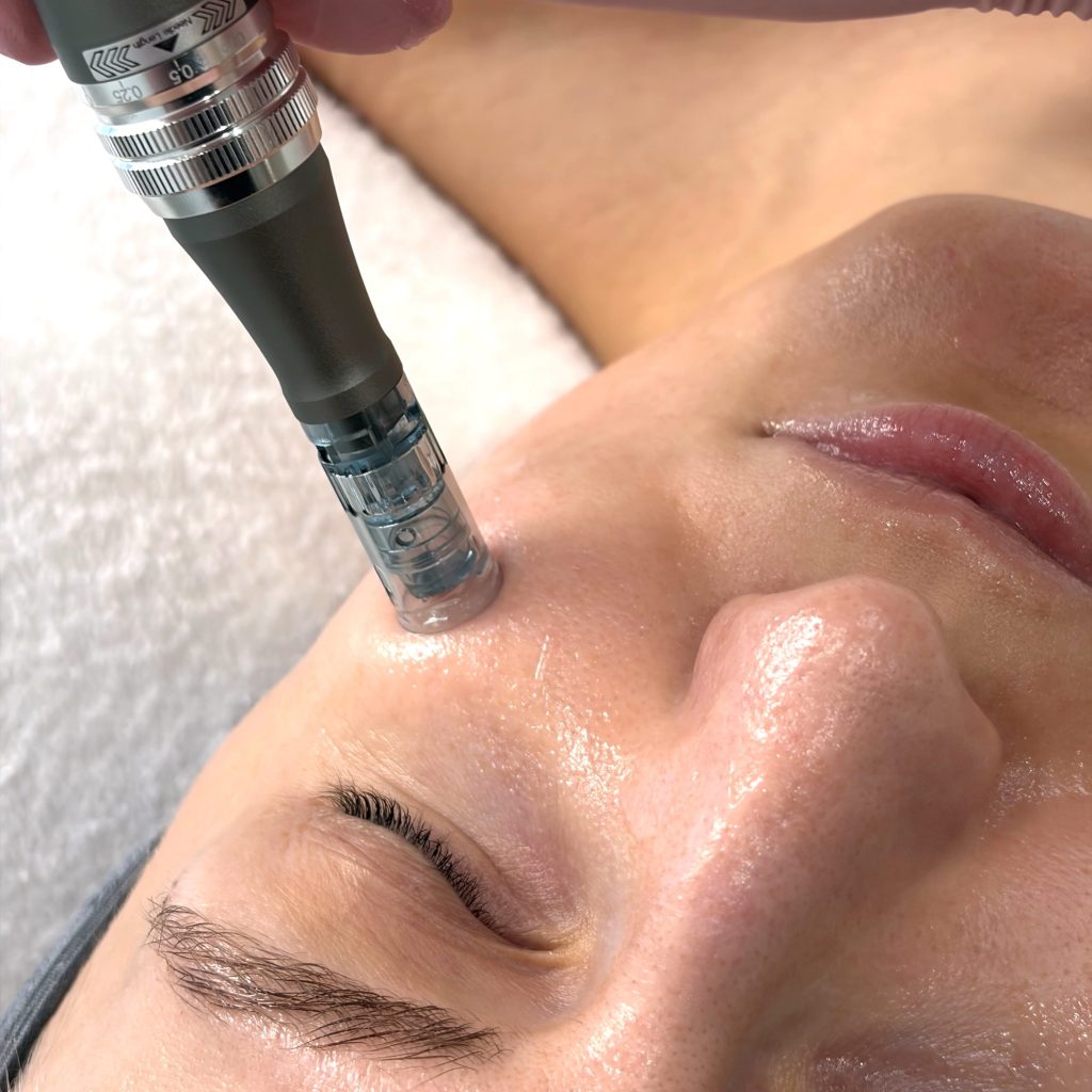 Mikroneulaus Helsinki -  Marijella, Etu-Töölö